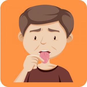 Diseases of the Mouth